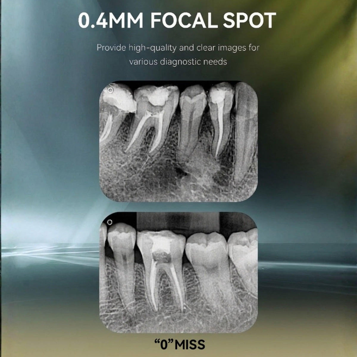 Advanced Ai-Ray X-Ray